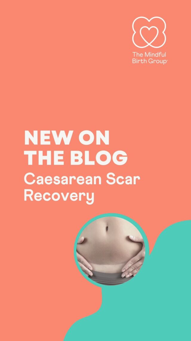 So you’re 6 weeks post a planned or unplanned caesarean birth and your GP check has given you the all-clear. That must mean that your scar is healed and all is well?

There’s much more to it than the skin healing well, and in our latest blog we share what scar recovery entails, what the symptoms are if things are not healing so well and what you can do to support it.

Head to the link in the bio or www.themindfulbirthgroup.com and click on ‘blog’.

#mindfulbirth #caesareanscar #scarmassage #abdominalbirth #scarhealing
